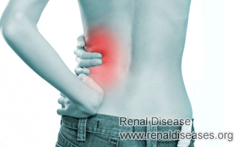 What Should PKD Patients Do If A Cyst Burst on Kidney