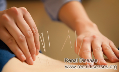 Is Acupuncture Good for Patients on Dialysis