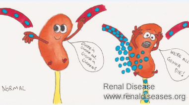 What Are Symptoms to Identify Kidney Deterioration