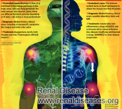 Bilateral Parenchymal Disease: Can Be Treated with Medicines