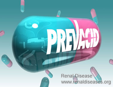  What Can I Take to Instead of Prevacid If I Have IgA Nephropathy