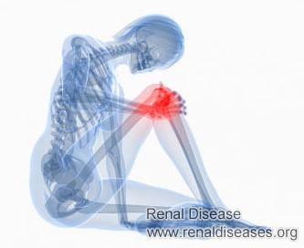 What Makes Bone Hurt After Dialysis