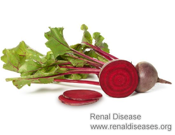 FSGS in End Stage Kidney Disease: If Beets Will Help with My Condition