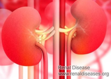 What to Expect with Stage 4 Kidney Failure