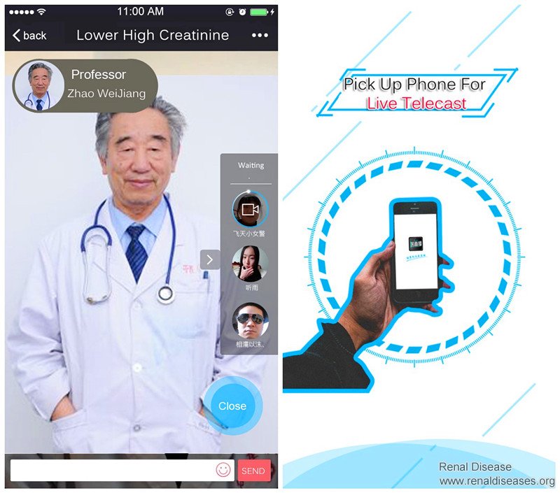 Good News: Pick Up Your Phone To See Live Telecast on Lowering High Creatinine