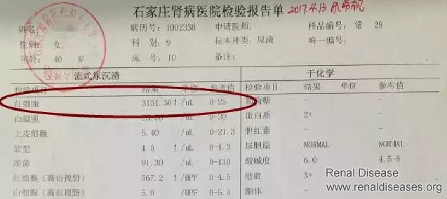 Does Blood Urine Mean Kidney Failure