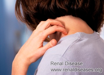 Skin Itching Treatment for Kidney Failure Patients