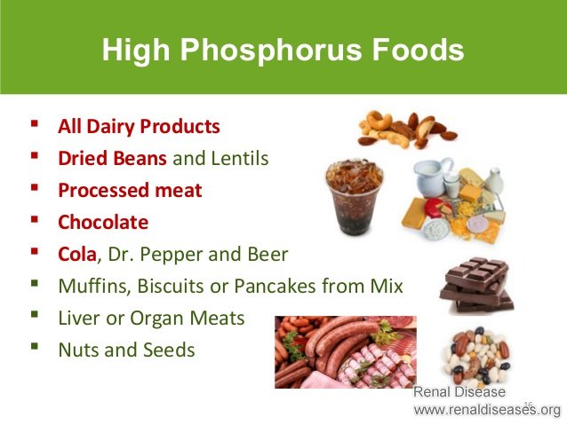 Stage 3 CKD: Do I Have to Watch Potassium and Phosphorus