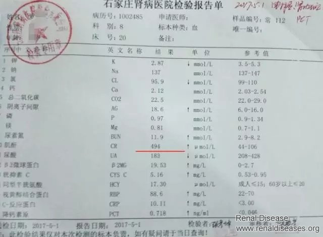 Kidney Failure and Gastrointestinal Bleeding: Creatinine Reduced from 1500 to 400