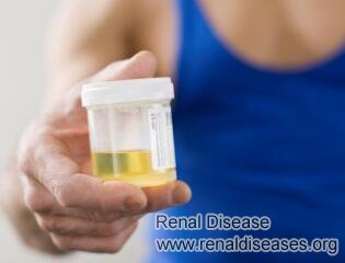 Do Dialysis Patients Still Urinate