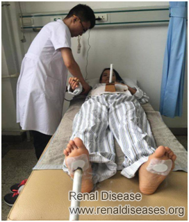 High Creatinine but No Other Symptoms