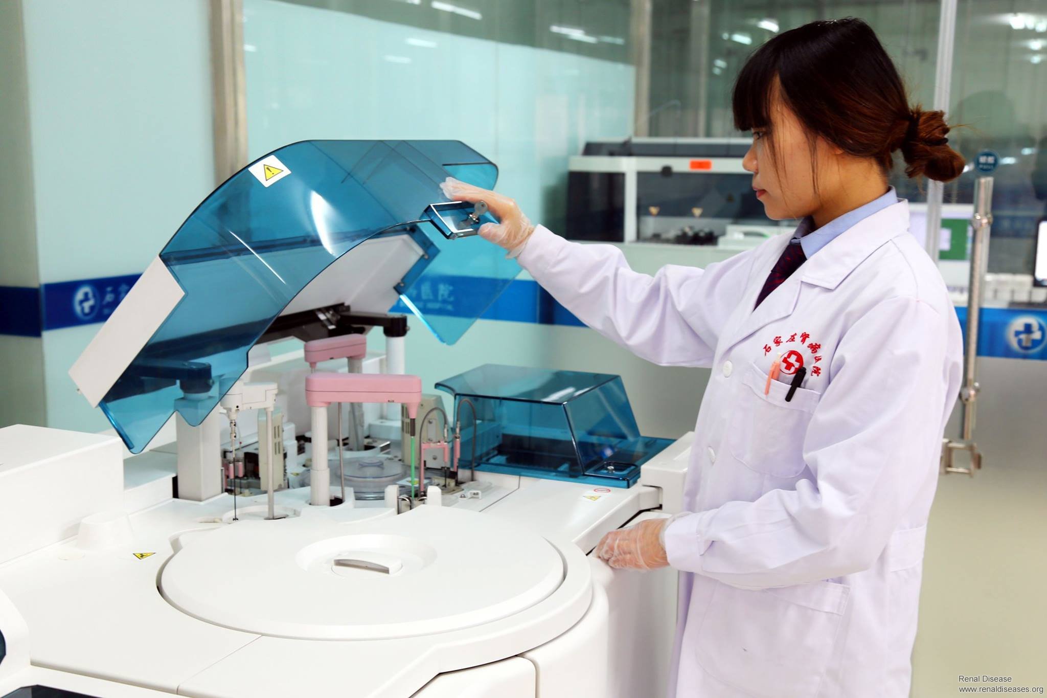 What Is the Fastest Way to Reduce Creatinine