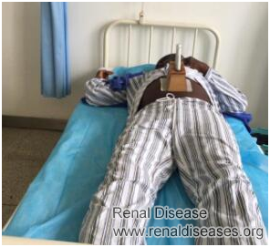Relieve Creatinine 2.9 and Urea 65