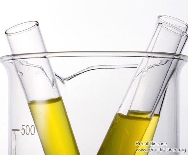 Does Urine Therapy Benefit in Kidney Failure