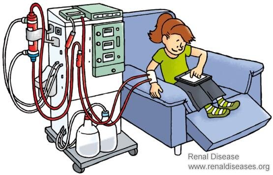Is There Any Chance to Live After Kidney Dialysis