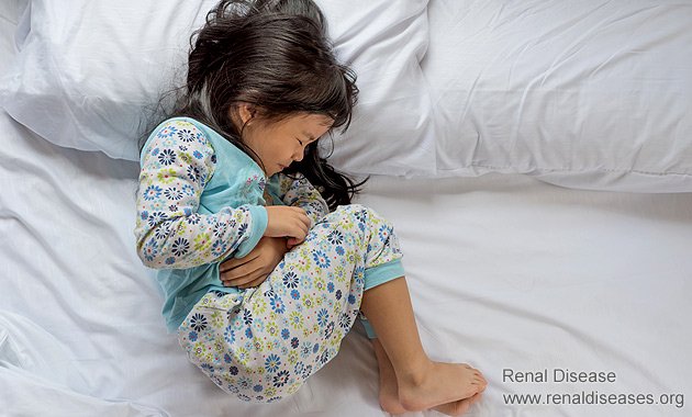 Loose Motions in Nephrotic Syndrome: How to Relieve It