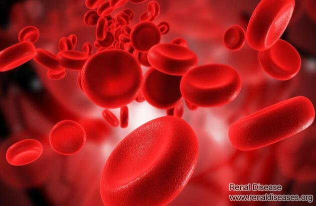 How to Remove Toxin Deposited in Kidneys