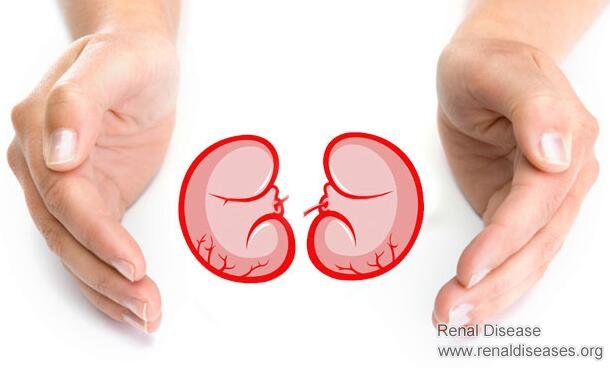 eGFR 23 and FSGS: How to Save My Kidneys