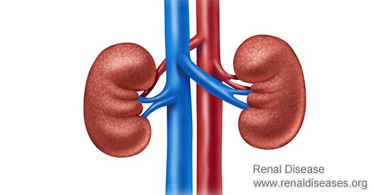 Can Failing Kidneys in A Diabetic Be Fixed