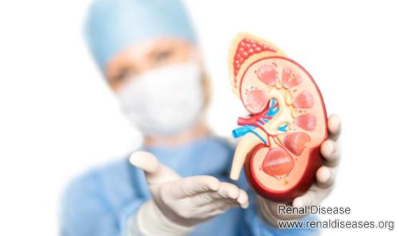 Can I Get My Kidney Removed if Complex Cysts Are on It