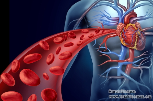 Treatment to improve blood circulation for dialysis patients