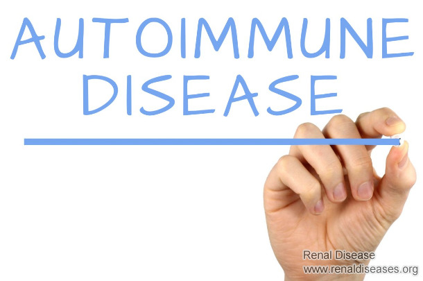 Is FSGS An Autoimmune Disease