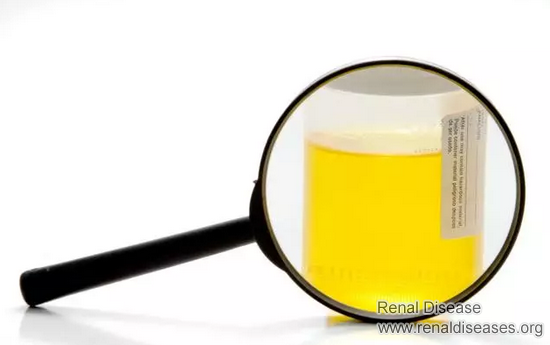 Two Indexes Help You Prevent Diabetes from Developing to Uremia