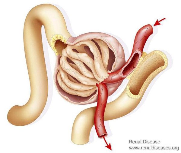 Proteinuria Is Mainly Due to This Part of Kidney Is Damaged