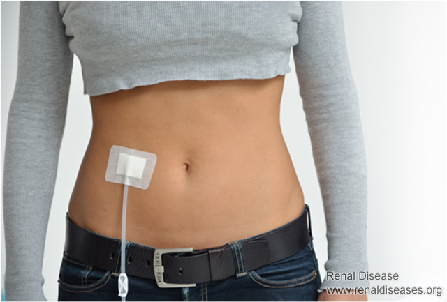 High Blood Creatinine Level May Be Not A Bad Thing
