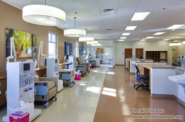 How Long Can ESRD Patients Live on Dialysis, and How to Treat Without Dialysis