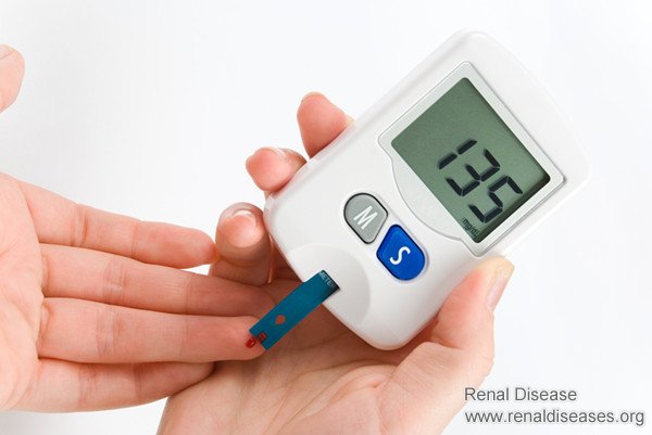 How Long Can ESRD Patients Live on Dialysis, and How to Treat Without Dialysis
