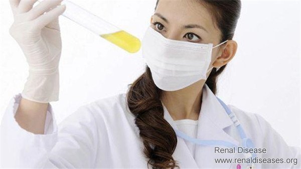 To Reduce Proteinuria, You Cannot Rely on Drugs Only