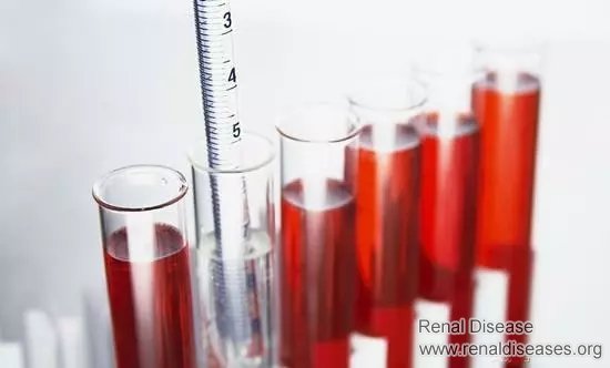 The Lower Creatinine Level, the Better Renal Function?