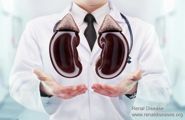 3 Golden Rules for Kidney Patients to Keep Uremia Far Away