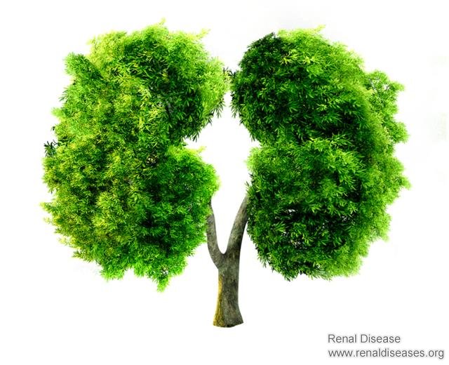 Why Your Nephritis Can Not Be Cured? Do You Know These 6 Causes?