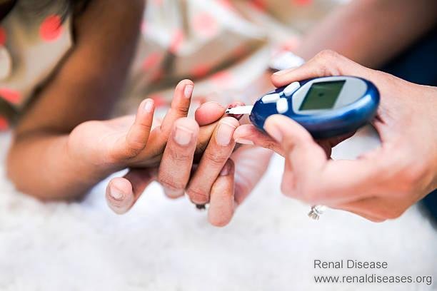 Four Abnormalities Indicate Diabetic Nephropathy