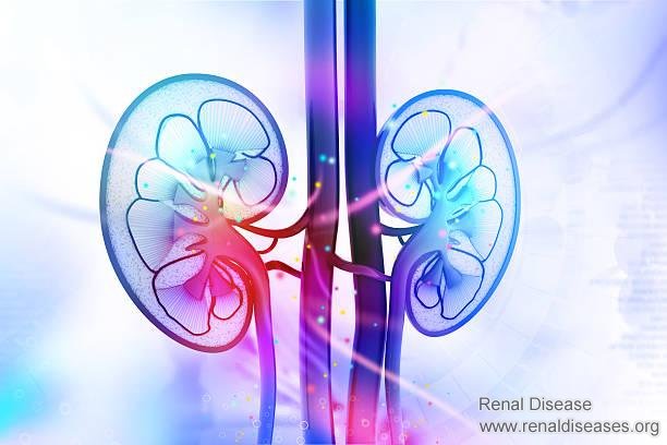 Why IgA Nephropathy Is Lingering