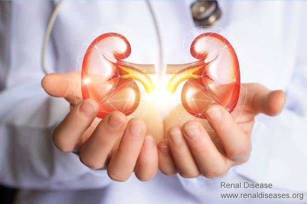 Why IgA Nephropathy Is Lingering