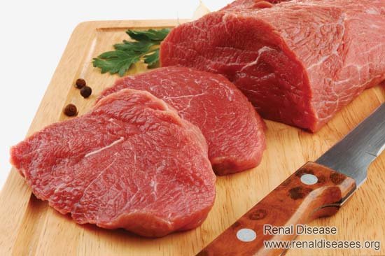 Why Beef Is Prohibited for FSGS Patients