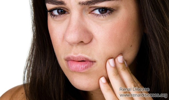 How Does Nephrotic Syndrome Cause Facial Oedema