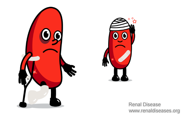 Kidney Damage due to Diabetes, Kidney Function 30: Can This Be Reversed