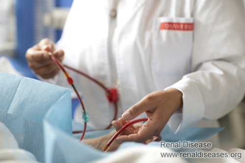 Is There Any Treatment to Help Kidney Failure Patients Avoid Dialysis