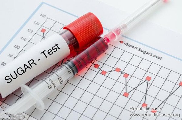 To Avoid Uremia, Diabetics Should Control These Three Indicators Well