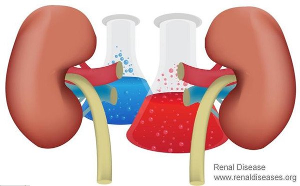 What to Do with High Creatinine? Doing These Things Helps Slow Down Kidney Deterioration