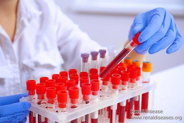What Happens to Patients Who Don’t Pay Attention to Reducing Creatinine