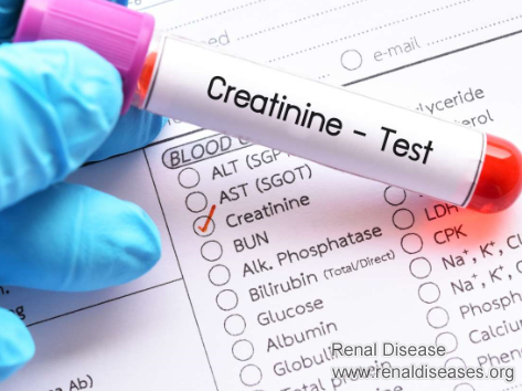 Why Creatinine Level Is Still High Even if Urinary Protein Reduces