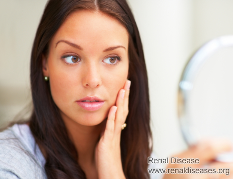 How Can I Lighten My Skin on Dialysis