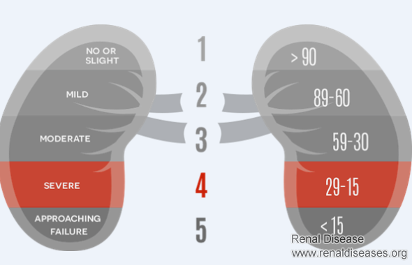 What Stage Is It with A GFR of 38