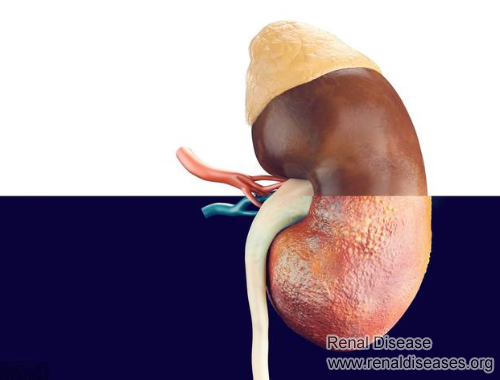 To Know More Information on High Creatinine