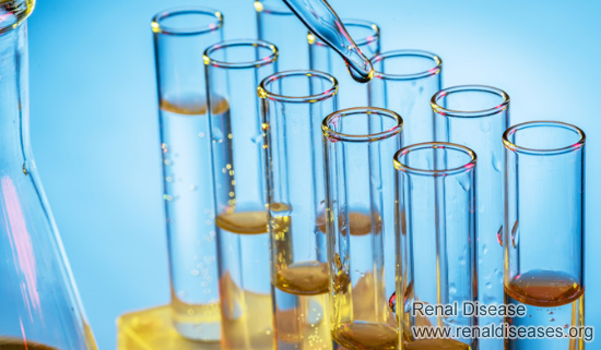 Persistent Proteinuria 2+ or More: What to Do